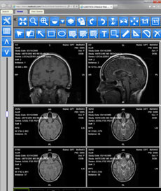 medical viewer demo